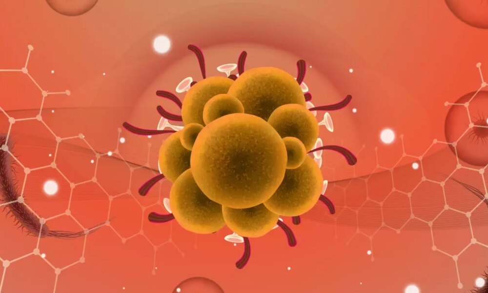 Enfeksiyon Hastalıkları Uzmanı Prof. Dr. Esin Davutoğlu Şenol, maymun çiçeği virüsü hakkında bilgi verdi