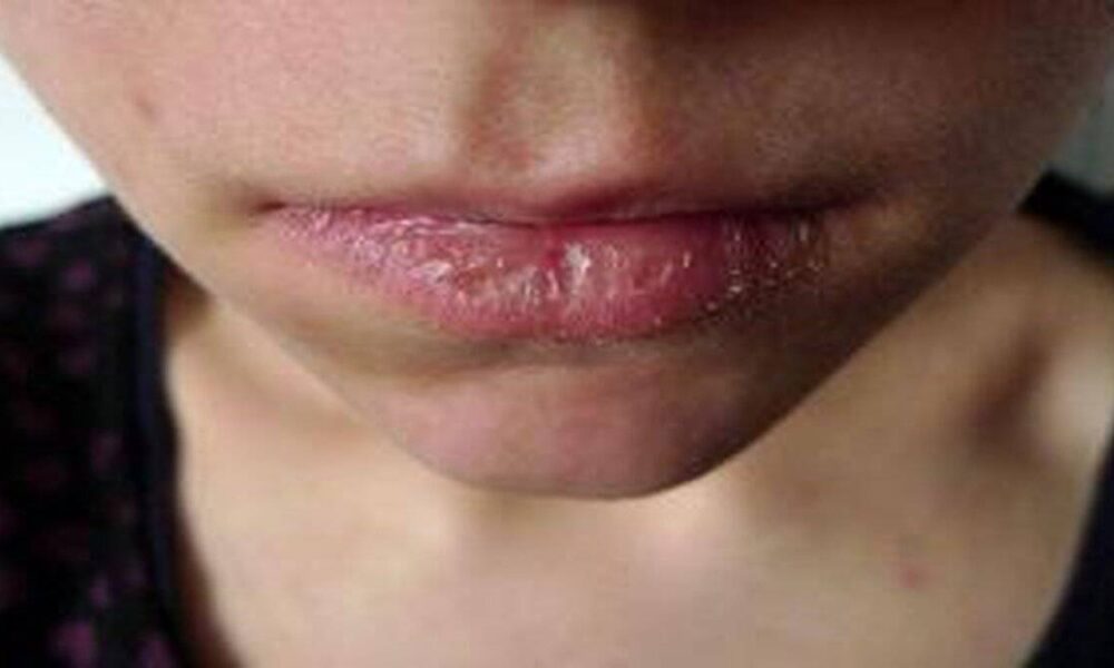 Dudaklarınıza ziyan veren bu alışkanlıktan kurtulun!