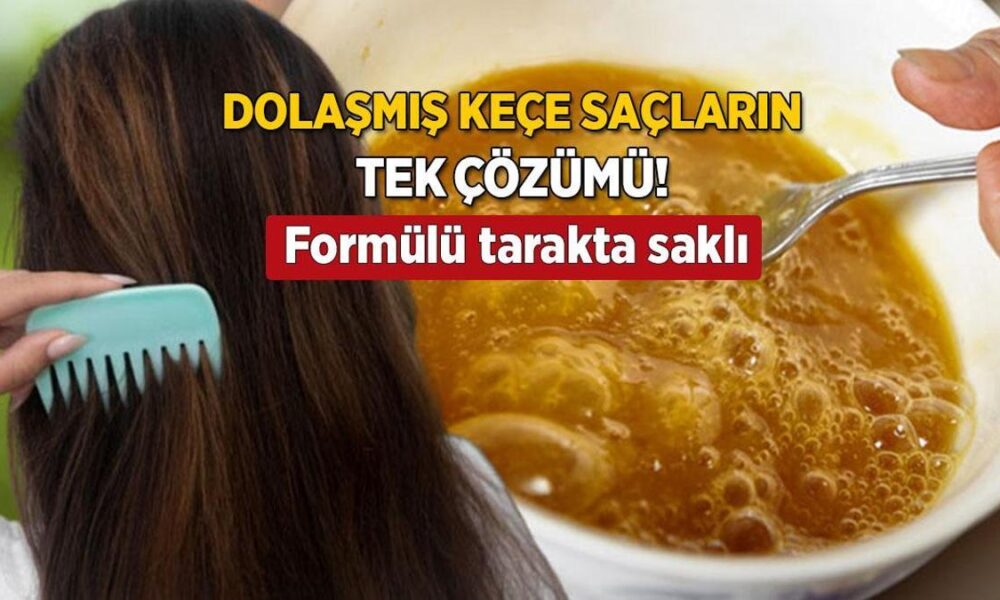 Keçe gibi dolaşan saçların tek çözümü! Yağ gibi kayıyor, formülü tarağında