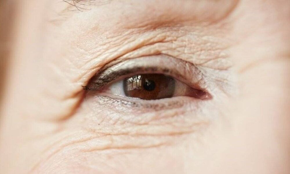 Kırışıklıklarla savaş! Cildinizi genç tutmanın püf noktaları