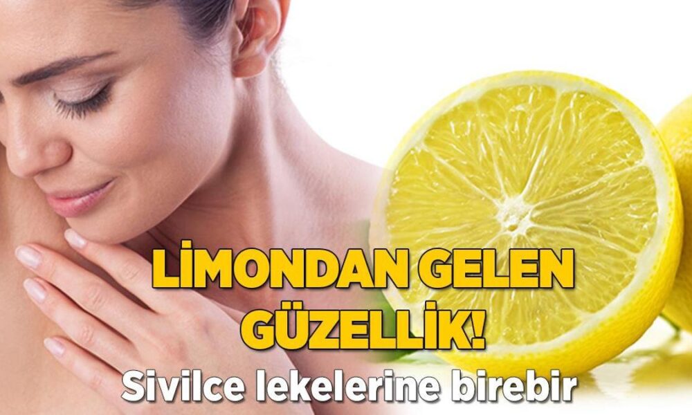 Limondan gelen güzellik! Sivilce lekelerine birebir, kararmayı yok ediyorLimondan gelen güzellik! Sivilce lekelerine birebir