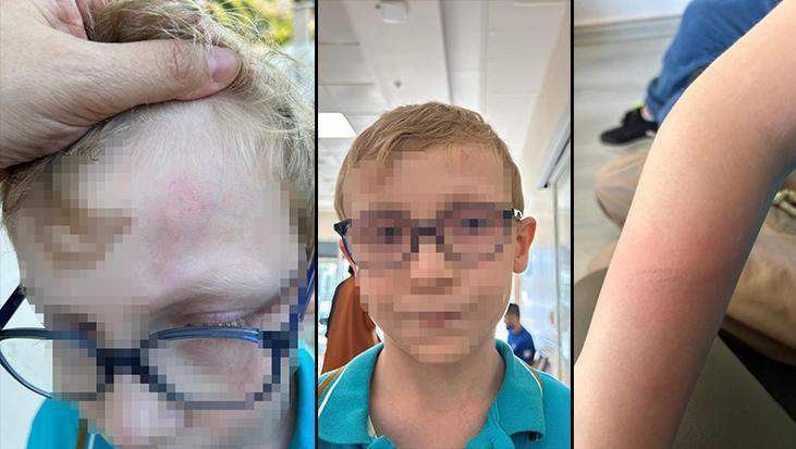 Okulda öğrenciye demir çubukla darp! ‘Çocuğumun canını nasıl onlara teslim edeceğim’