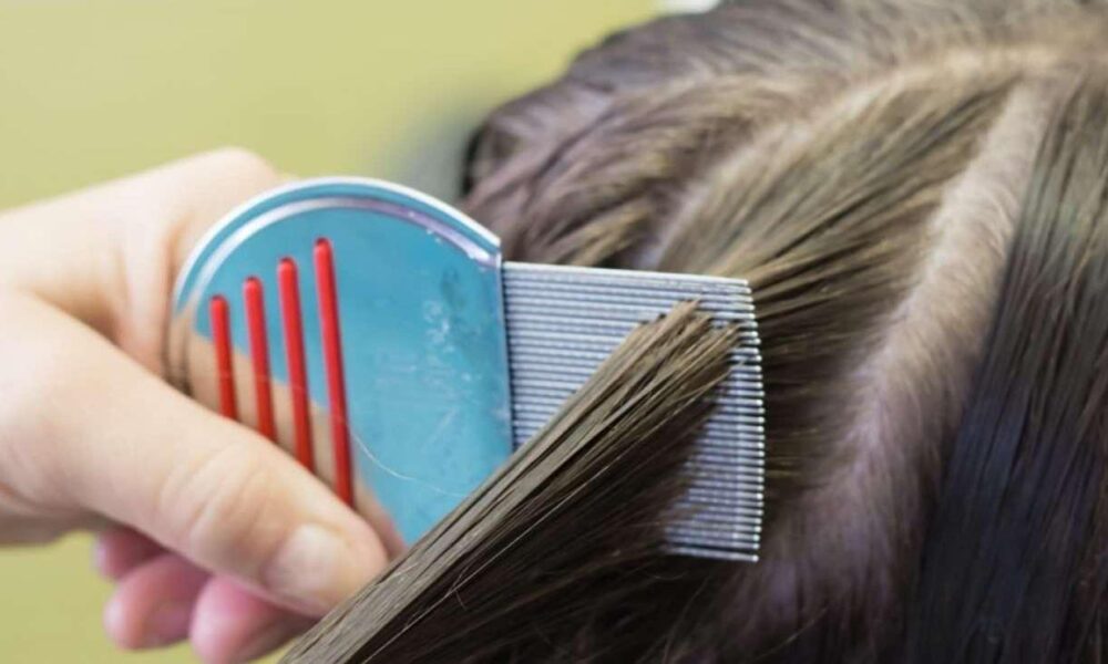 Saçtaki bit yumurtaları nasıl yok edilir? Sirke, pire ve bit yumurtası kaç günde geçer?