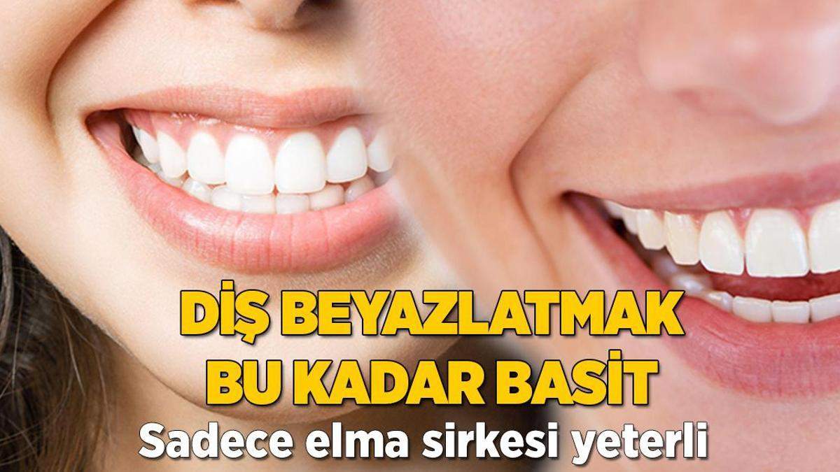 Diş beyazlatmak bu kadar basit! Sadece bir malzeme yeterli, doğal yöntem