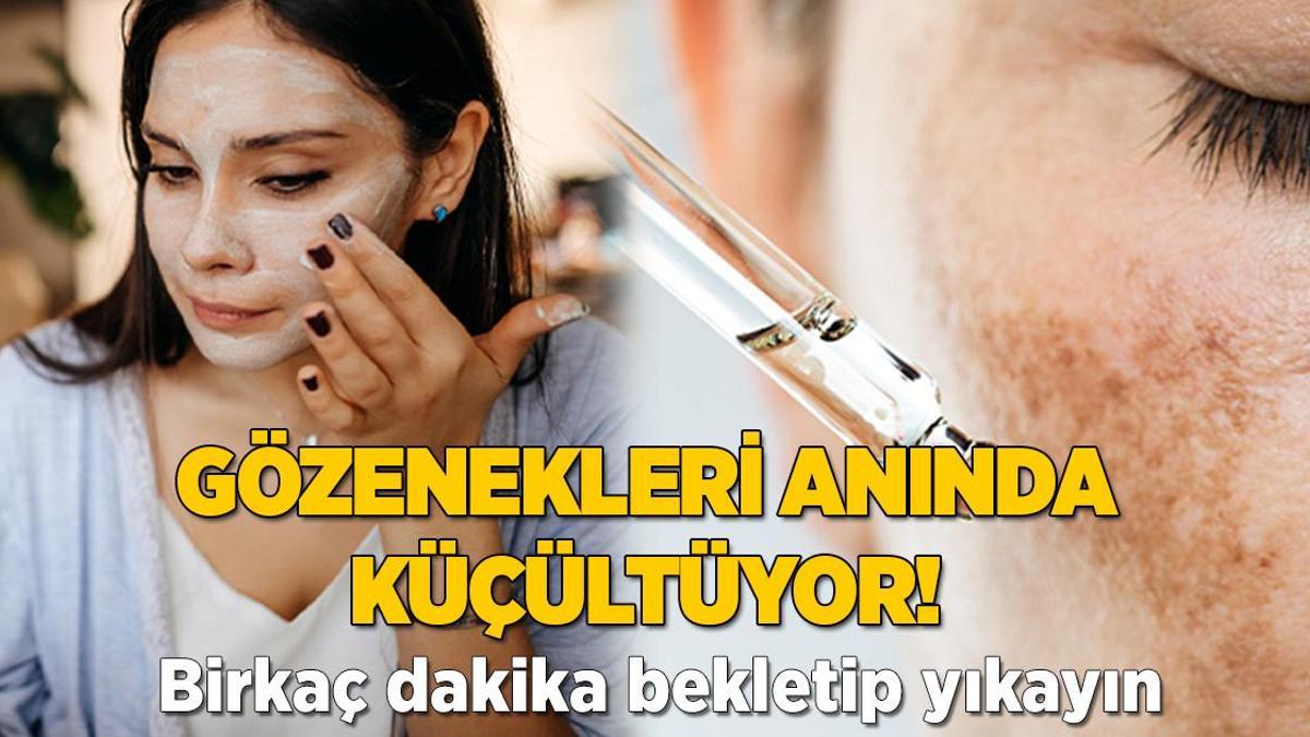 Gözenekleri anında küçültüyor! Birkaç dakika bekletip yıkayın, en iyi çözümmüş