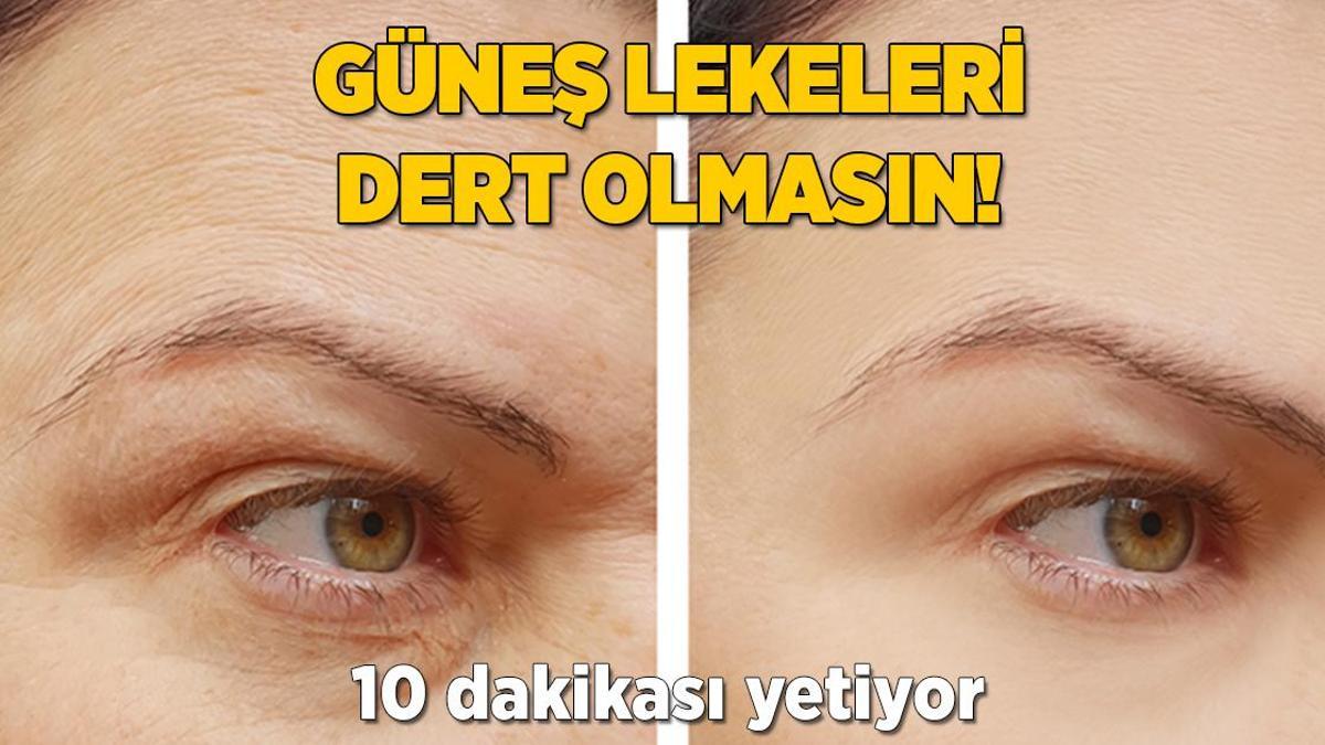 Güneş lekeleri dert olmasın! 10 dakikası yetiyor, bu yöntemleri deneyin