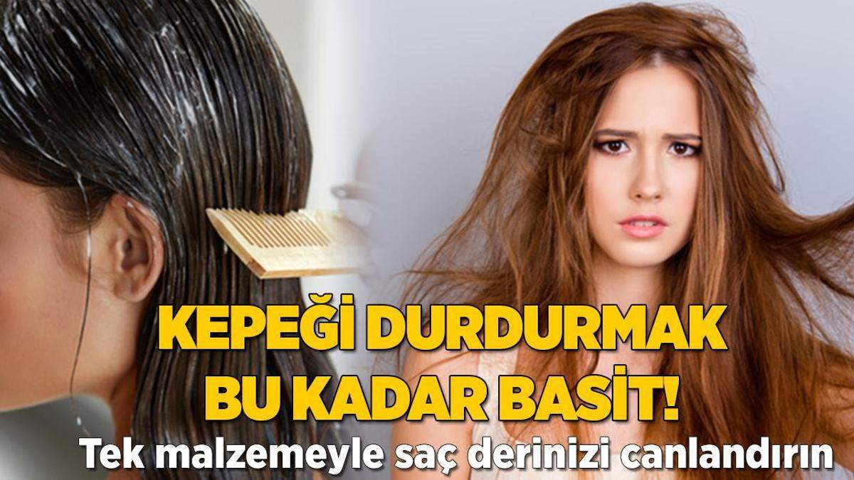 Kepeği durdurmak bu kadar basit! Tek malzemeyle saç derisini canlandırın