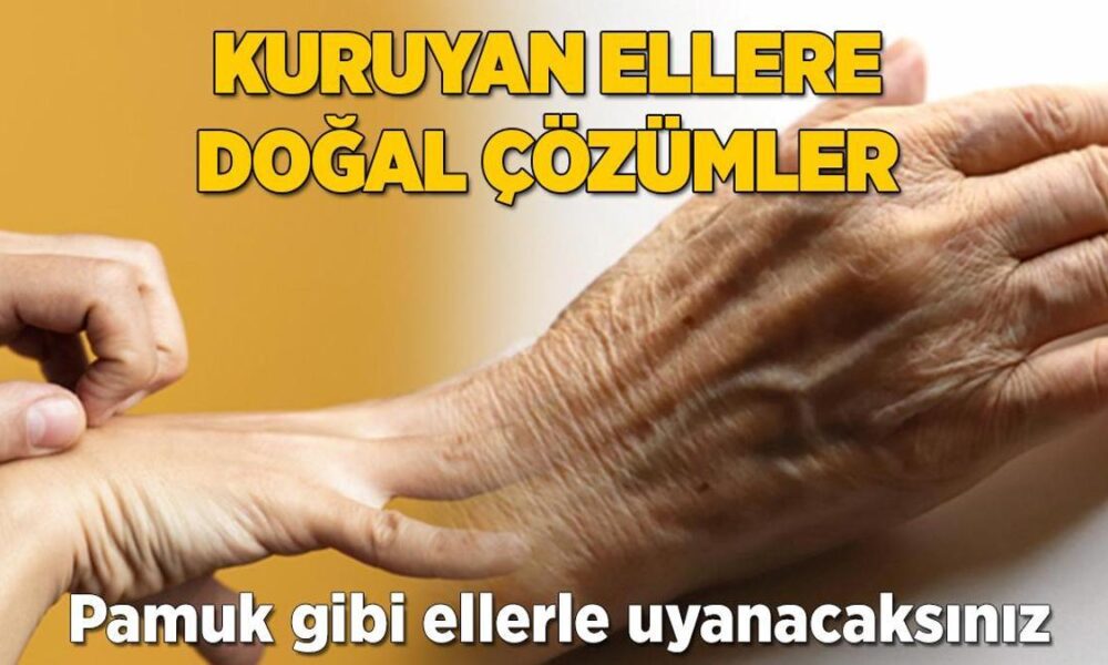 Kuruyan ellere evde doğal çözümler! Yatmadan önce sürün, pamuk gibi olacak