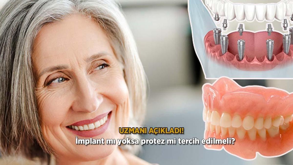 Uzmanı açıkladı! İmplant mı yoksa protez mi tercih edilmeli?