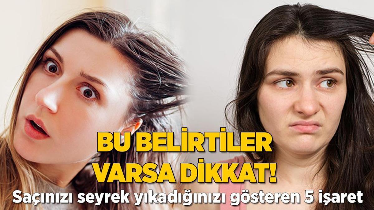 Saçınızı az yıkıyorsanız dikkat! Belirtileri gözlemleyin, dökülebilir